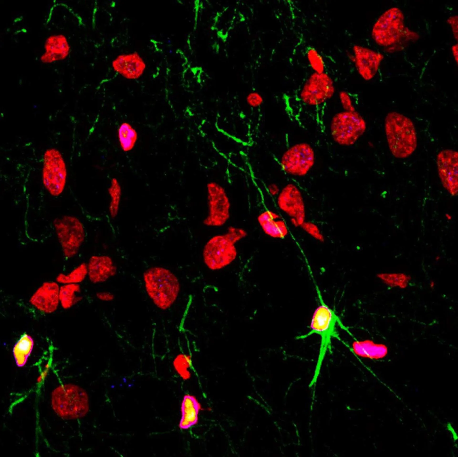 Las enfermedades mentales, el alcohol y las drogas merman la producción neuronas nuevas