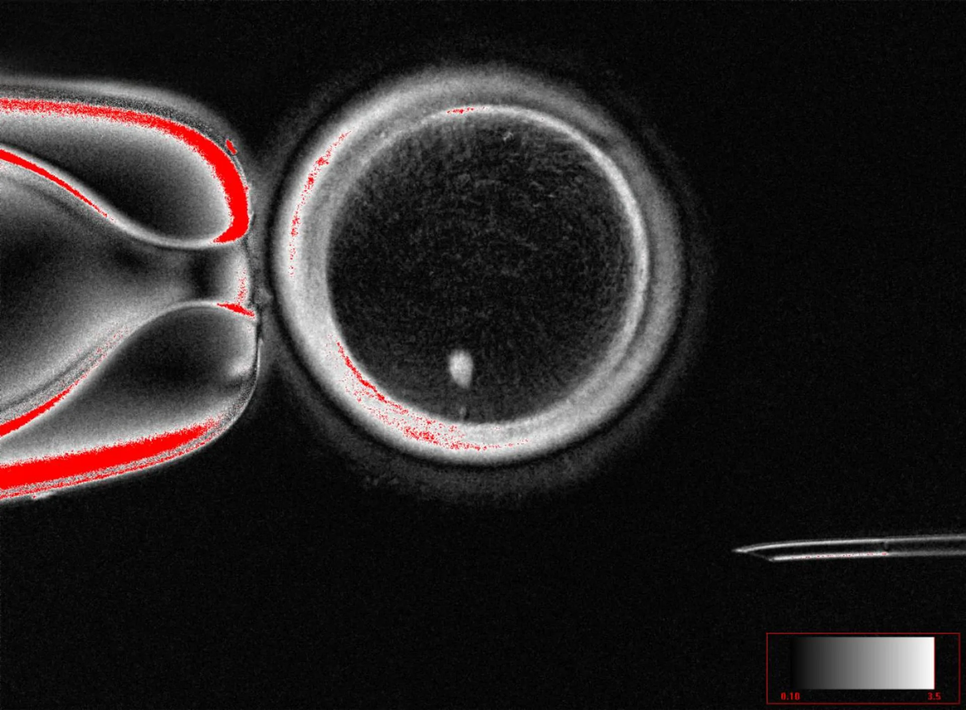 Ovocito humano con transferencia nuclear de células somáticas con huso visible (punto brillante en el interior) antes de la fecundación. EFE/Mitalipov laboratory